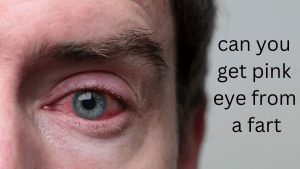 Close-up image of a person with red, irritated eye, possibly pink eye, accompanied by text asking 'can you get pink eye from a fart'