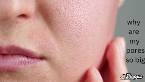 Close-up image of a person’s cheek and mouth area with visibly large pores, highlighting skin texture, with the question 'why are my pores so big' on the right side.